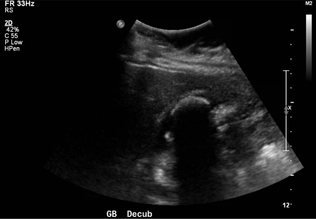 WES Ultrasound Decub. JETem 2017 - JETem