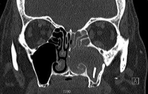 Creative Commons images