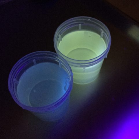 Case Report: Antifreeze Ingestion and Urine Fluorescence - JETem