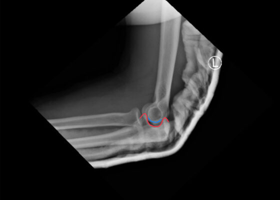 DRUJ Elbow Xray, Lateral, Post Reduction, Annotated. JETem 2020