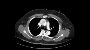 Creative Commons images