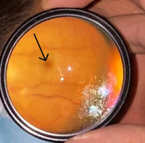 CRAO Exam. JETem 2023