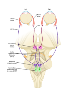 Internuclear Ophthalmoplegia. JETem 2024