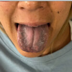 Blackened Tongue. Photo. JETem 2026