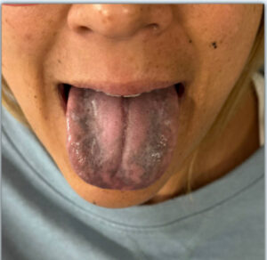 Blackened Tongue. Photo. JETem 2026