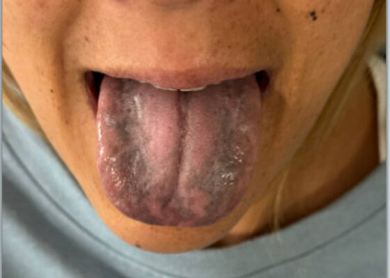 Blackened Tongue. Photo. JETem 2026