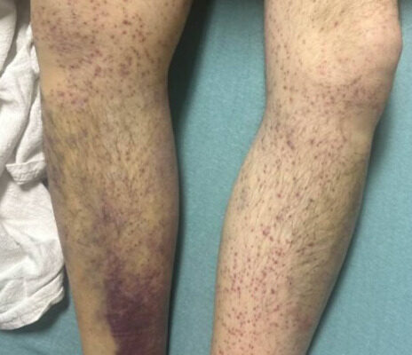 Scurvy Linked to Food Insecurity. Photo B. Unannotated. JETem 2026