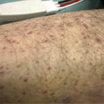 Scurvy Linked to Food Insecurity. Photo D. Annotated. JETem 2026