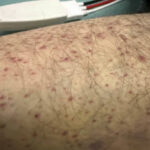 Scurvy Linked to Food Insecurity. Photo D. Unannotated. JETem 2026