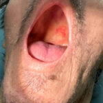 Scurvy Linked to Food Insecurity. Photo E. Unannotated. JETem 2026