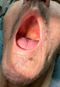 Scurvy Linked to Food Insecurity. Photo E. Unannotated. JETem 2026