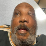 Sinonasal Carcinoma. Photo 2. JETem 2026