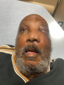 Sinonasal Carcinoma. Photo 2. JETem 2026